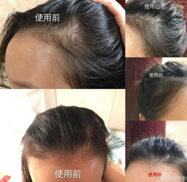 未曝光的“洗发水名单”,满满的添加剂?别小瞧,用错的人不少