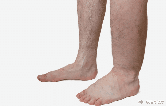 血栓|血管堵塞最怕“一种水”，若你爱喝，冲走垃圾，血管一通到底