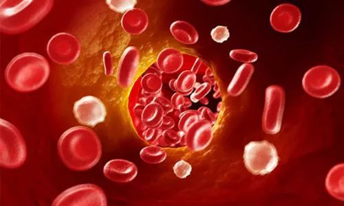 高血脂|医生提醒:脑供血不足的人,这3物请务必要少吃,否则脑梗随时会来