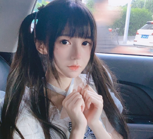 脱发|蔡萝莉晒水晶高跟鞋，意外暴露脱发严重，花10多万植发也没用？