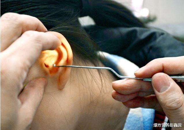 高血压|耳朵经常发痒，又掏不出东西？没你想的那么简单，或许是3个问题