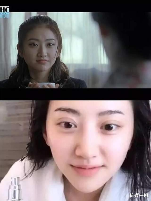 景甜|人间富贵花撞脸悲伤蛙？脸颊发肿眼袋重，景甜颜值下滑这么厉害？