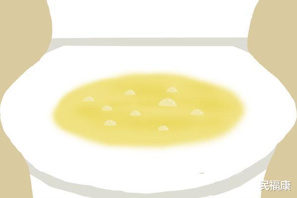 饮食|尿酸升高，腿先知？腿部出现哪些异常，说明尿酸或已高到离谱了？