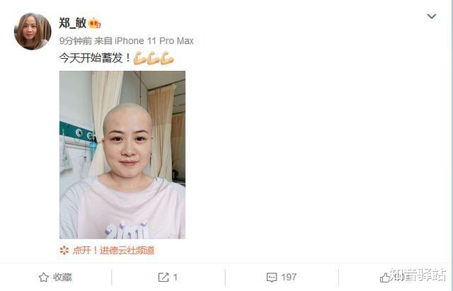 岳云鹏|6月16日,妻子郑敏剃光头入院,看岳云鹏的人生:悲喜就在一瞬间