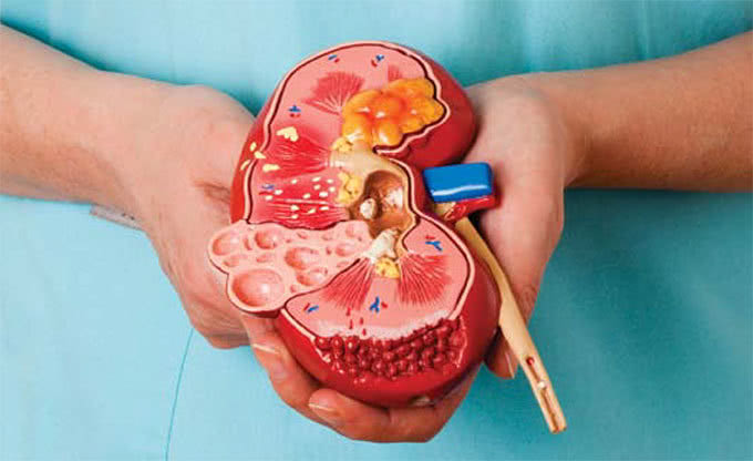 肾虚▲人有三急,肾有“三怕”!经常做这3件事的人,十有八九肾不好