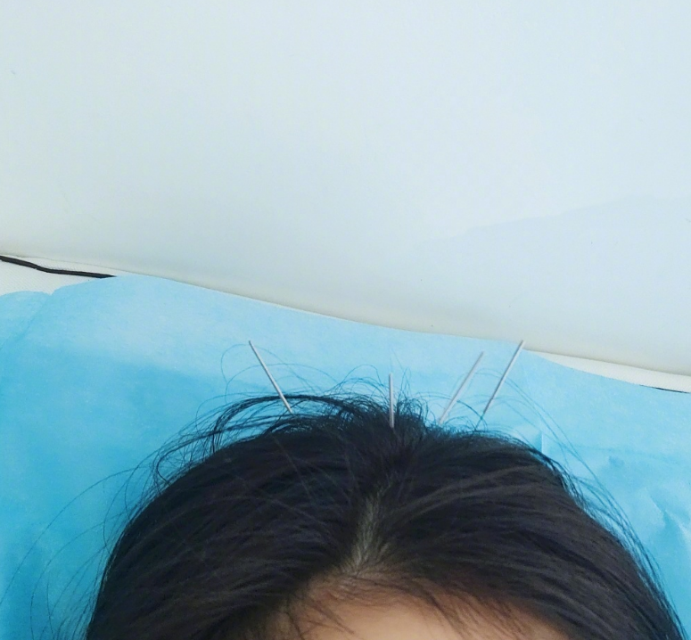 杨幂|杨幂内衣广告海报惊艳曝光，穿露脐套装大秀马甲线，傲人身材太绝