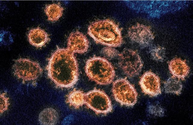 「世界卫生组织」欧美等国慌了手脚，世卫组织公开病毒起源