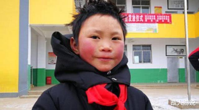 冻伤|2年前,那个满头冰花、脸蛋冻伤也要上学的男孩,现在怎样了?