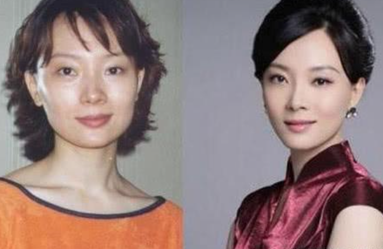 整容|“整容最成功”的女明星！明明不知道动过多少刀子，但却毫无痕迹