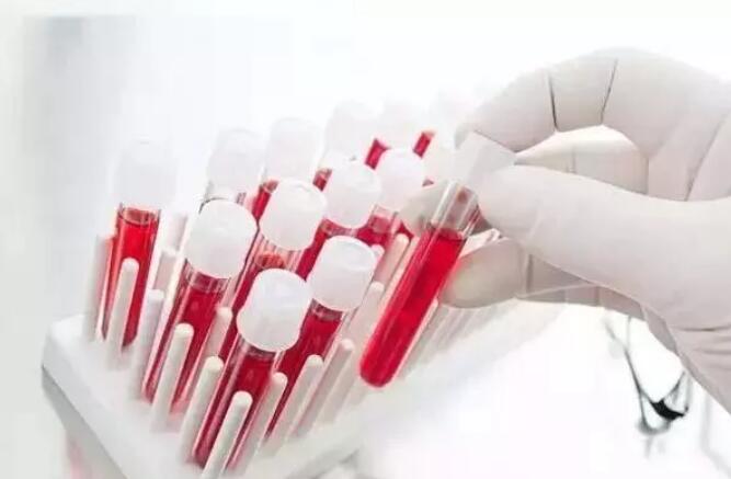 「高血脂」高血脂真正敌人并非肥肉，该忌口了，别等血管堵塞，脑梗来才后悔