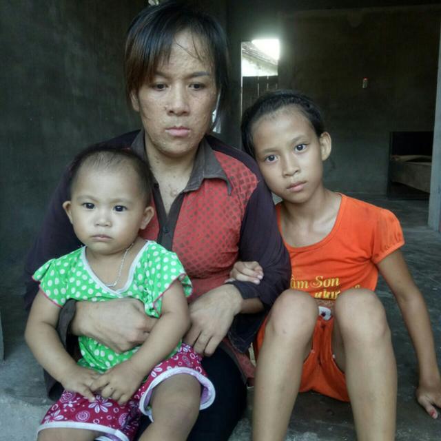 睹图|女子先后和两任男友生下2个孩子，如今自己患病还要独自养娃