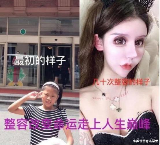 [整容]“网红女孩”13岁开始整容，3年整容100次花费百万，现状令人唏嘘