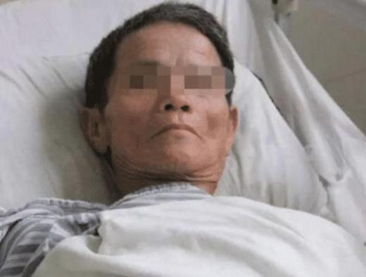 #肝脏#38岁男子胸口出现“红蜘蛛”，结果查出肝癌，医生：都怪你自己