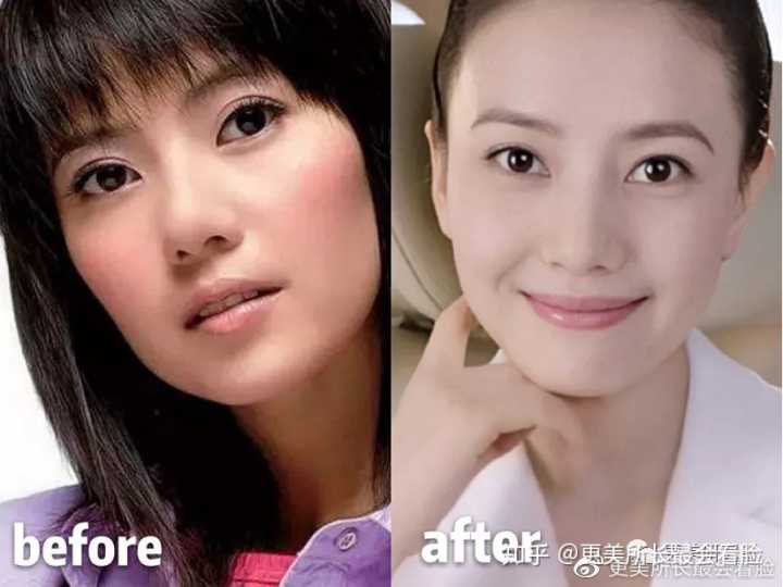 朴敏英|有没有那种颧骨高而很好看的女生？