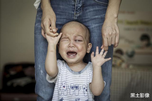 黑土影像|广西一男婴出生37天双眼有如“玻璃珠”，检查结果出来父母傻眼了