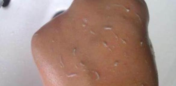 『』还觉得洗澡搓出泥很爽？当你知道搓它的后果，你就会笑不出来了