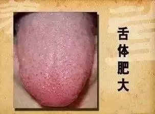 芡实■原来祛湿气最厉害的,不是薏米,而是它!