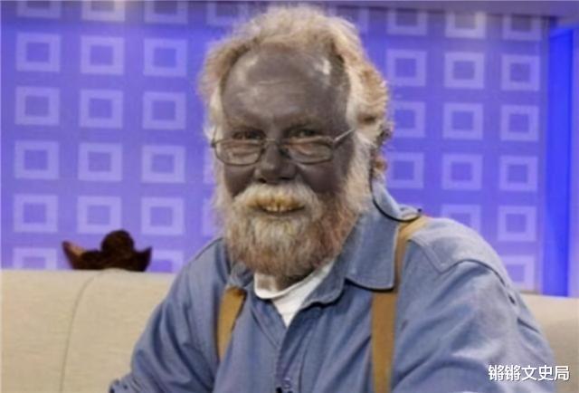 星团|世界上绿种人不足3000，血是绿色，他们靠光合作用能活下去？