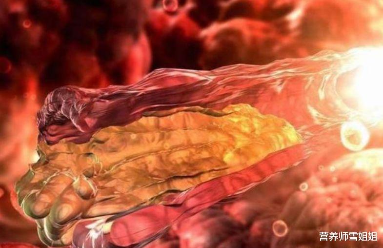 「熬夜」血液粘稠的人，喝好三杯水，谨记“四句话”，减少血栓，更健康