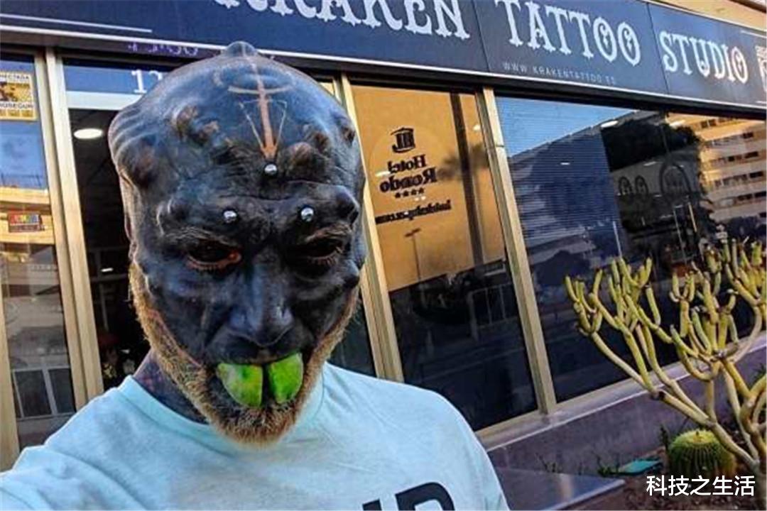 白矮星|法国男子为让自己变成“外星人”，做多项手术，如今的模样令人惋惜！