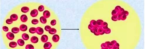 疾控■我国最罕见血型在江苏出现,已被国际基因库收录,全球仅此一例