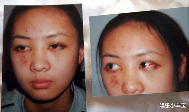 童瑶■17年前跪地求张默放过，暴打事件后沉寂多年，童瑶把一手烂牌打出“王炸”