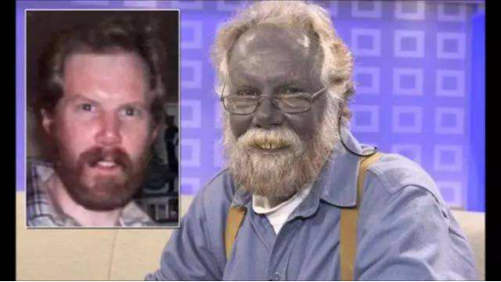 ##这些人体内流着“白银血脉”？但是却如同遭受“诅咒”，全身泛蓝