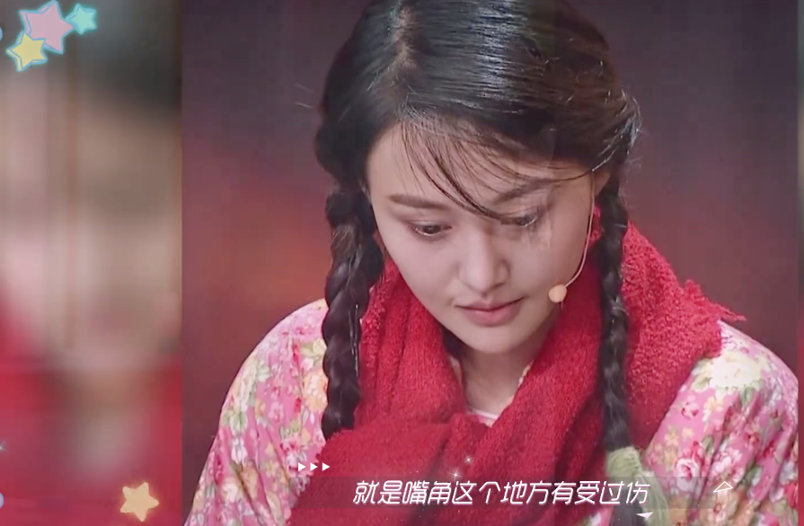 [郑爽]郑爽说出自己嘴角疤痕原因，她的回答让戚薇愣一跳，听着都嫌疼