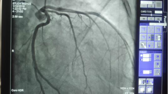 达·芬奇|达芬奇曾画出人的心脏，还画出细微结构，人们花了500多年才找到