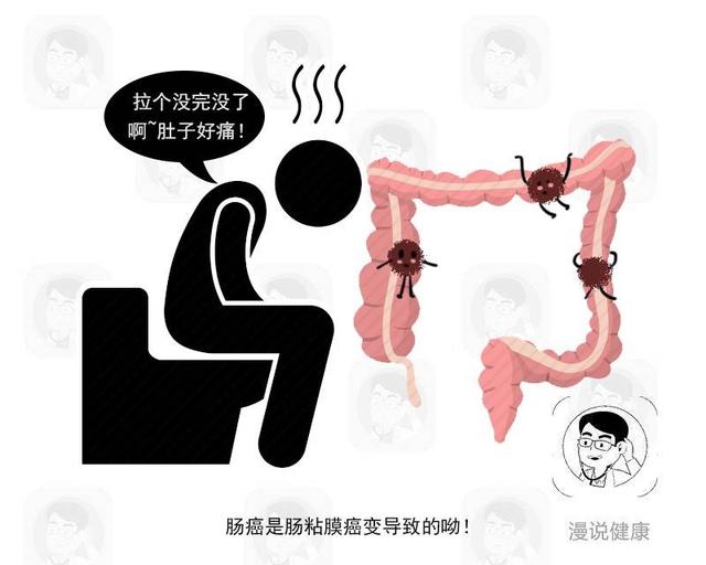 直肠癌|体内有癌，排便先知？上大号出现5个特征，当心直肠癌在慢慢靠近