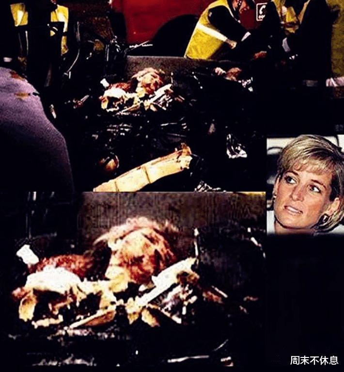 戴安娜|无法重拍的老照片,图3戴安娜被撞的面目全非,图5被医生害死的迈克杰克逊