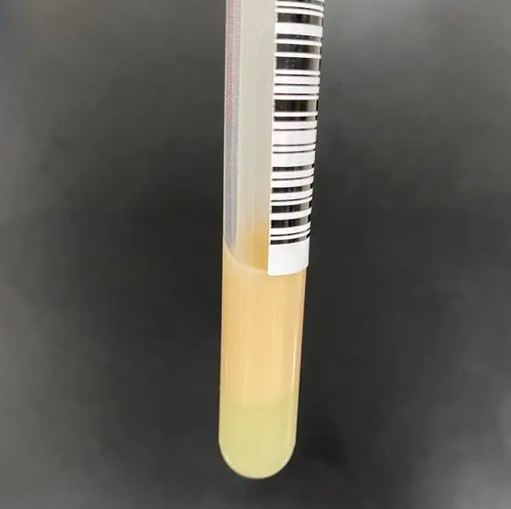 医生|小伙被蛇咬伤，治疗时意外发现血竟是乳白色的！网友：蛇救了你啊