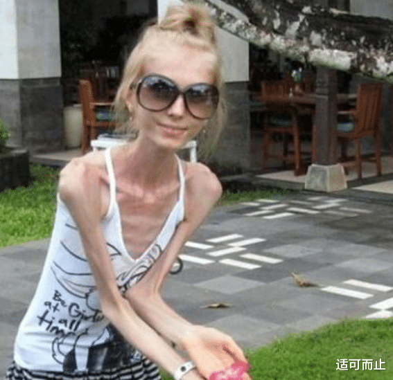 女孩|世界上最瘦的女人，因太瘦嫁不出去，体重仅20公斤瘦得只剩下骨头！