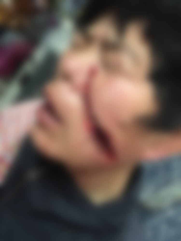 淄博▲惊心!大连一对夫妻锯树,电锯却弹向妻子的脸