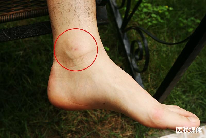 衰老|男性开始衰老,下半身3个异常“藏不住”,提前告诉你真相