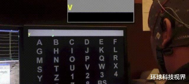 |马斯克成功在猪脑上做实验，脑机接口成功，植入后无排异