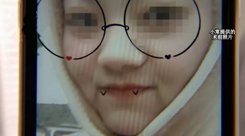 杭州|漂亮姑娘刚怀孕,鼻尖出现神秘白色物体!婆婆追问下,她瞒不住了…