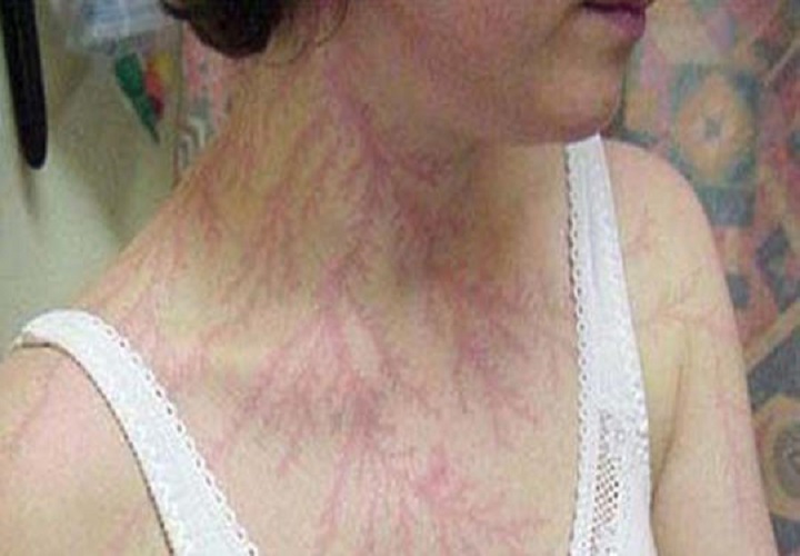 @被雷劈过的那些人,身上都留下了一些特殊印记