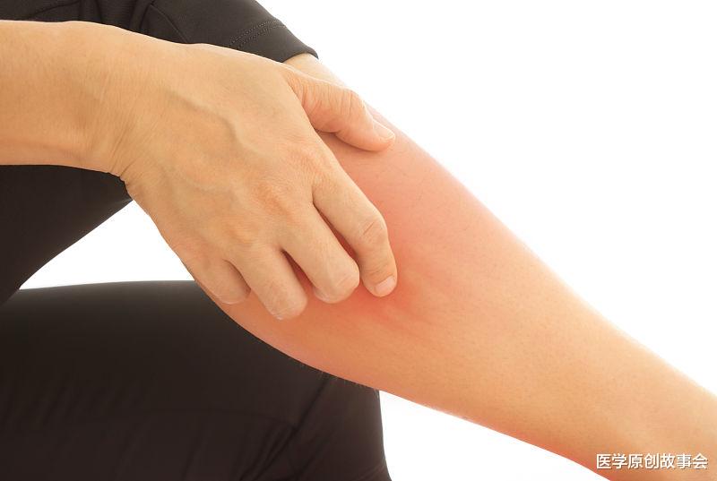 皮肤瘙痒|体内有癌,皮肤先知,皮肤若有这四种变化,很可能是癌症的信号