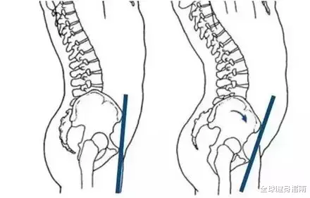 迪丽热巴：热巴哪有什么蝴蝶臀？不过是肋骨外翻！