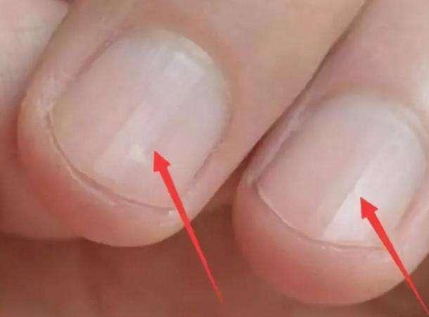 肝脏@肝不好，4类蔬菜要少吃！晨起没有这5个表现！说明肝脏很“轻松”