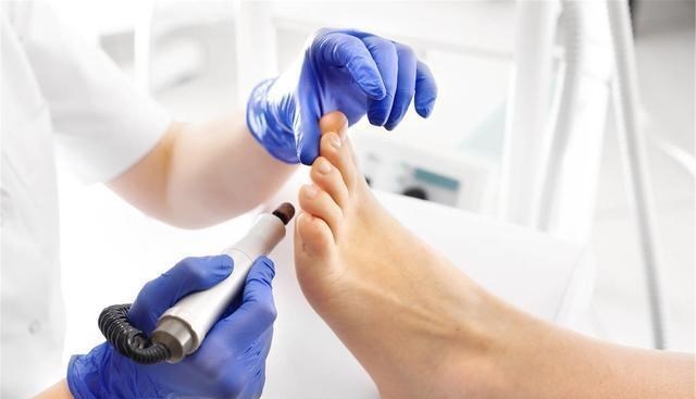 疾病|肾不好，脚先知？脚上若有3种“东西”，祝贺，说明肾还不赖