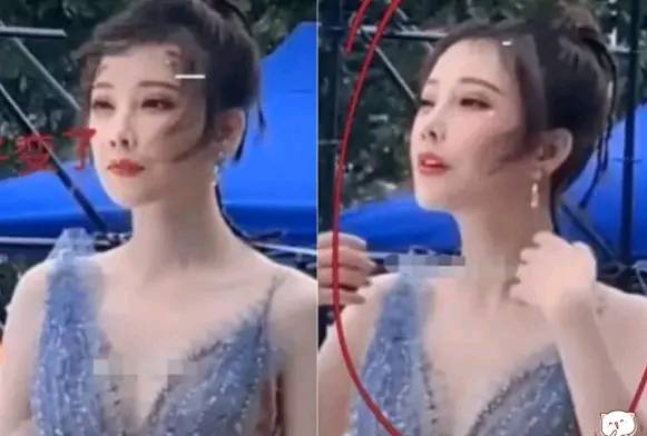 冯提莫|冯提莫疑似整容失败，鼻子成颜值bug，事业发展遇瓶颈？