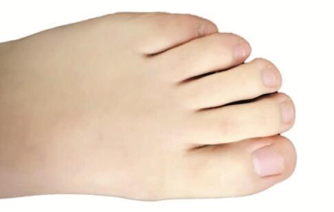 【疾病】体内有疾,双脚先知,脚部出现这些表现,可能是疾病发出的信号!