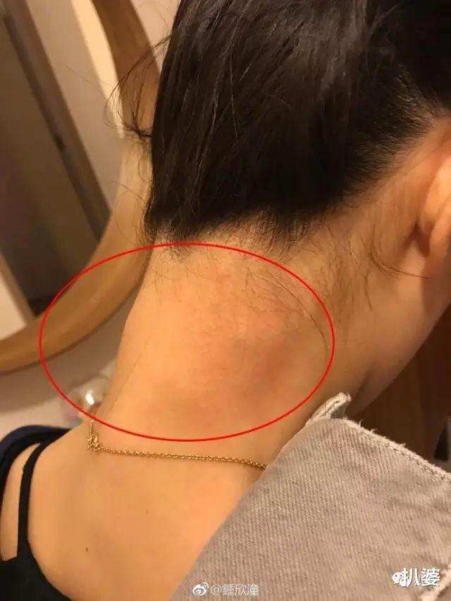 阿娇|离奇受伤的阿娇，又有新故事了。