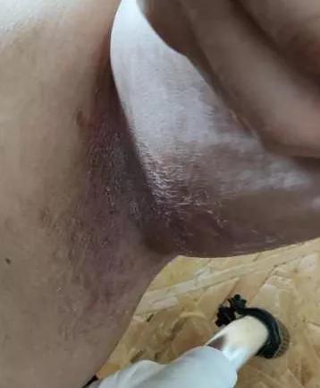 生活报|半年后再见母亲，身上长着大面积褥疮！哈尔滨一女士投诉一元智慧居家养老