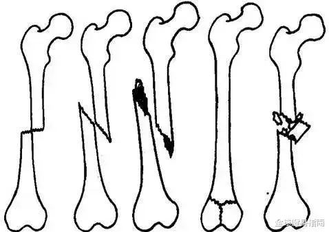 医生|想学杨幂的正骨大法？劝你慎重！