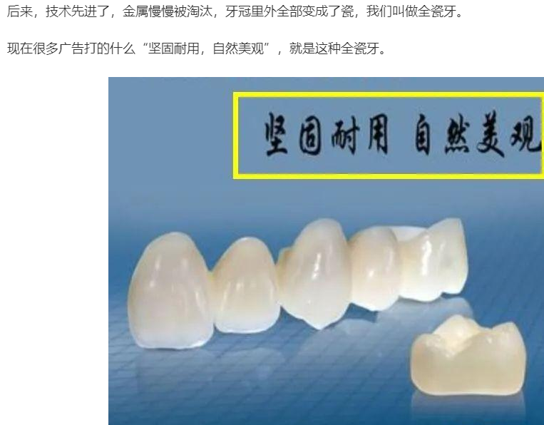 牙科|明星再瞎整烤瓷牙，就会变成封面上的马，哈哈哈哈！