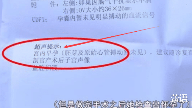 抽脂|女子做完抽脂手术，才发现已怀孕40天，人流后被丈夫离婚