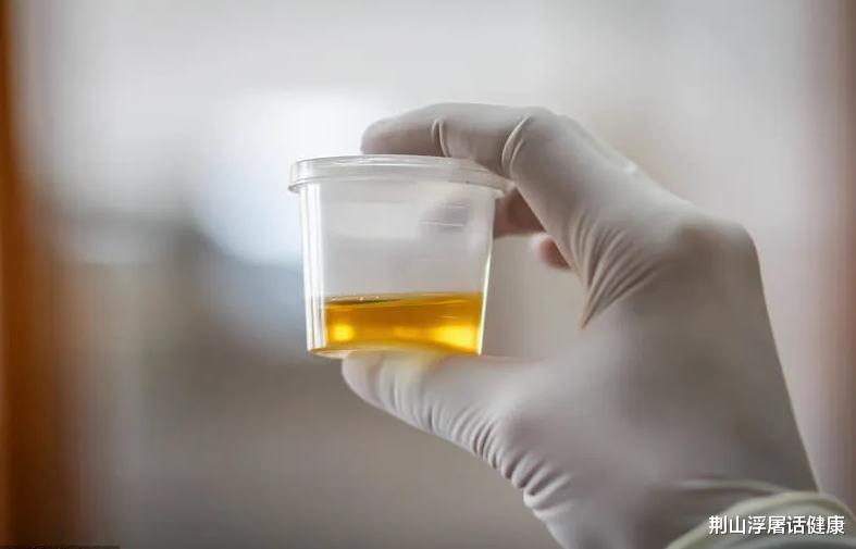 肝脏|肝开始变“硬”时，身体会有这4种“反应”，若一个没占，恭喜你